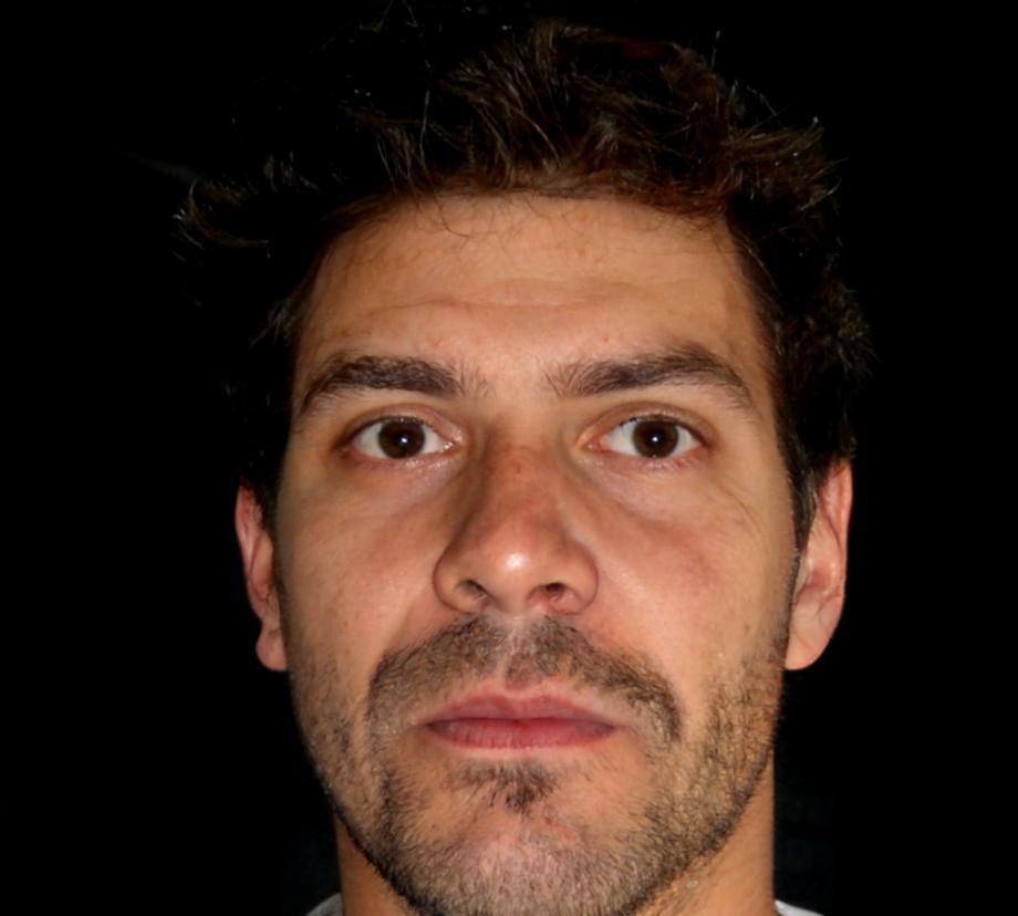 Portrait de Rémi Boudreault
